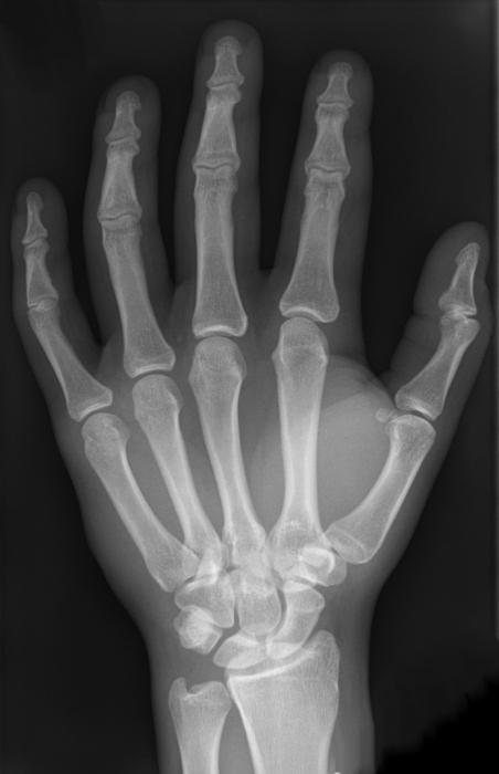 структура костију руке